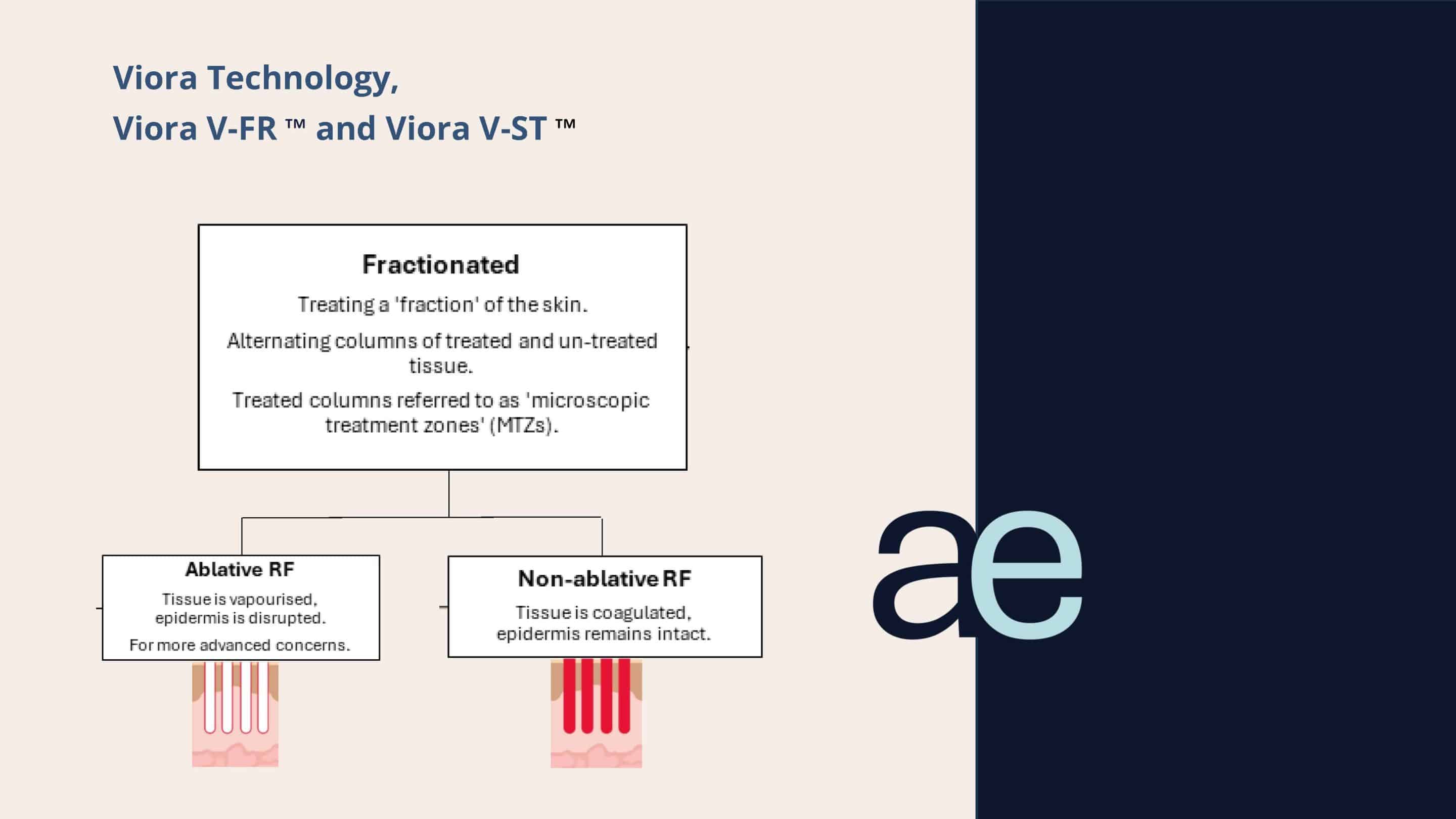 Viora technology Viora V-ST and Viora V-FR